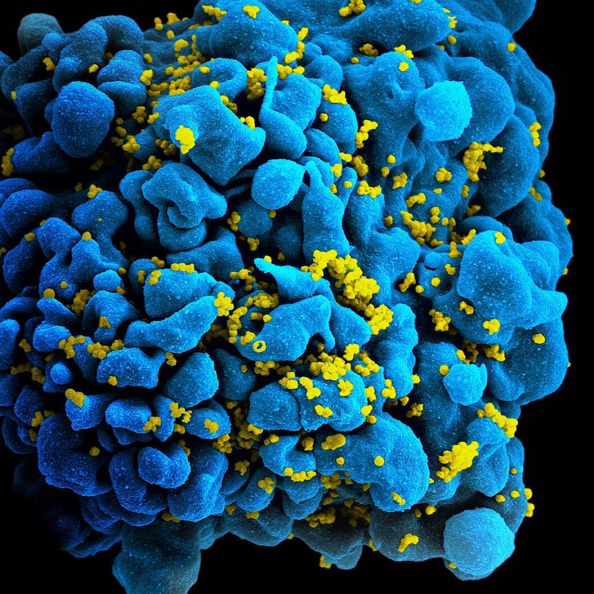 HIV Vaccine Efficacy Study to Launch in Sub-Saharan Africa