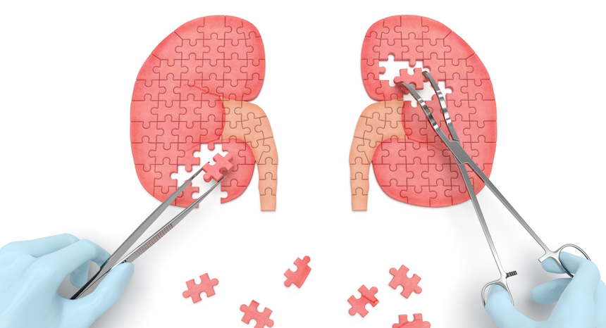 Chronic Kidney Disease Is Still a Major Health Challenge in Africa